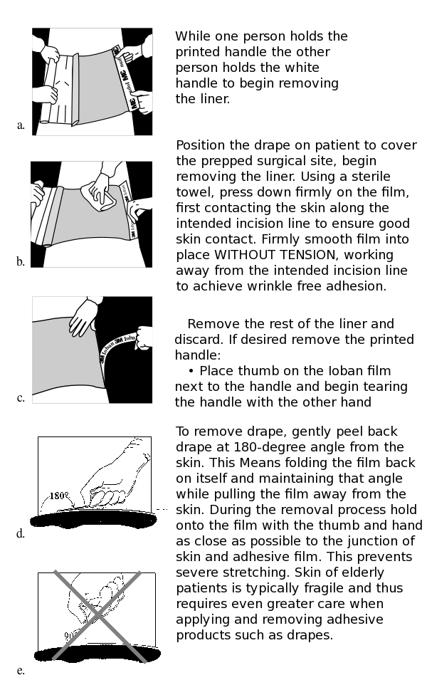 IOBAN Instructions